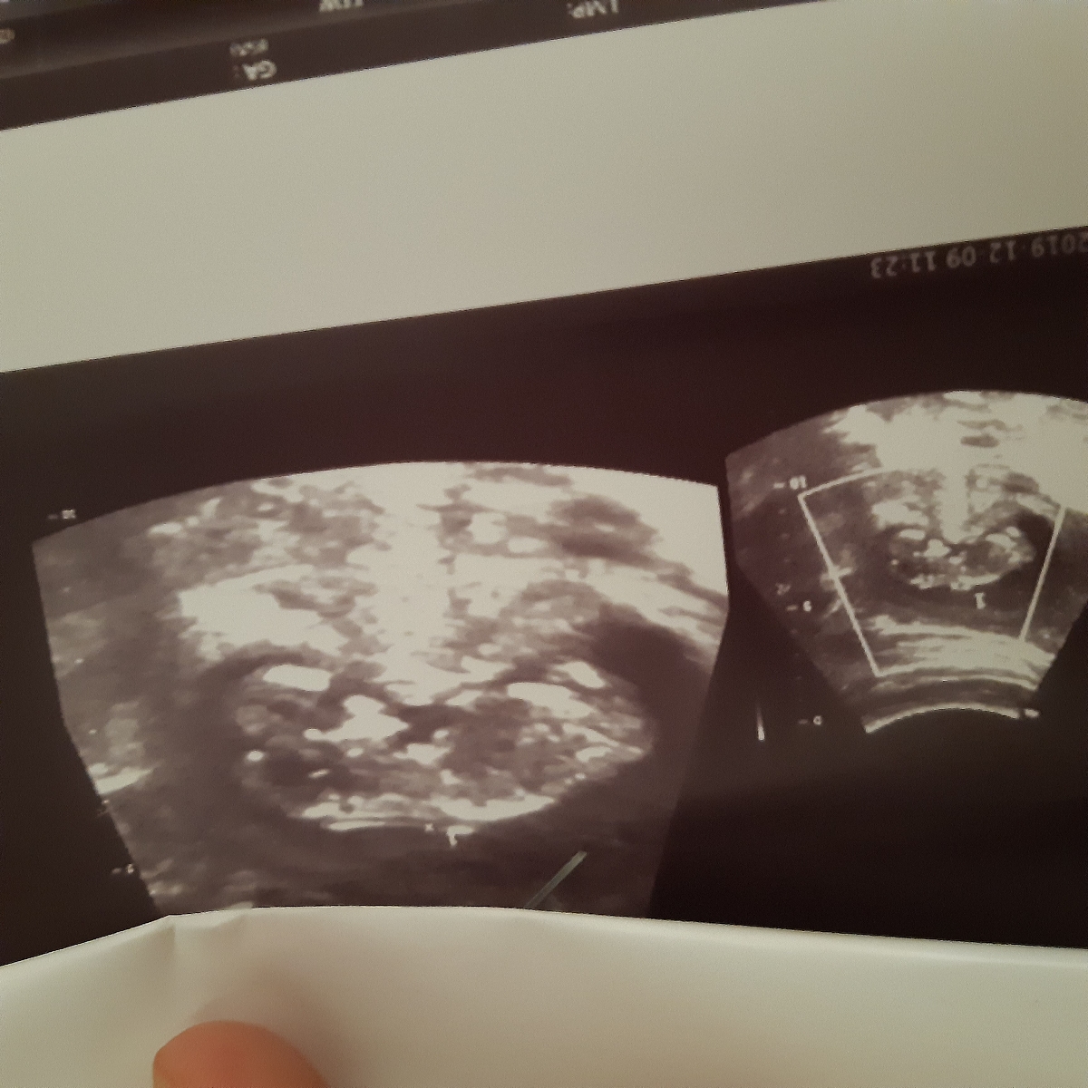 بچهها بیاید تعیین جنسیت کنید لطفا بچهها بیاید تعیین جنسیت کنید لطفا