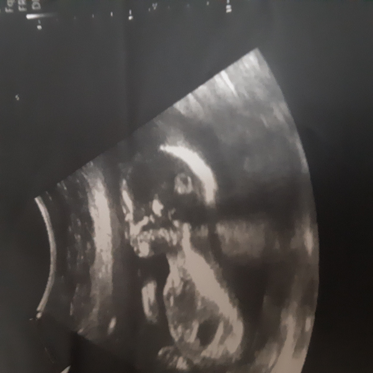 بچهها بیاید تعیین جنسیت کنید لطفا بچهها بیاید تعیین جنسیت کنید لطفا