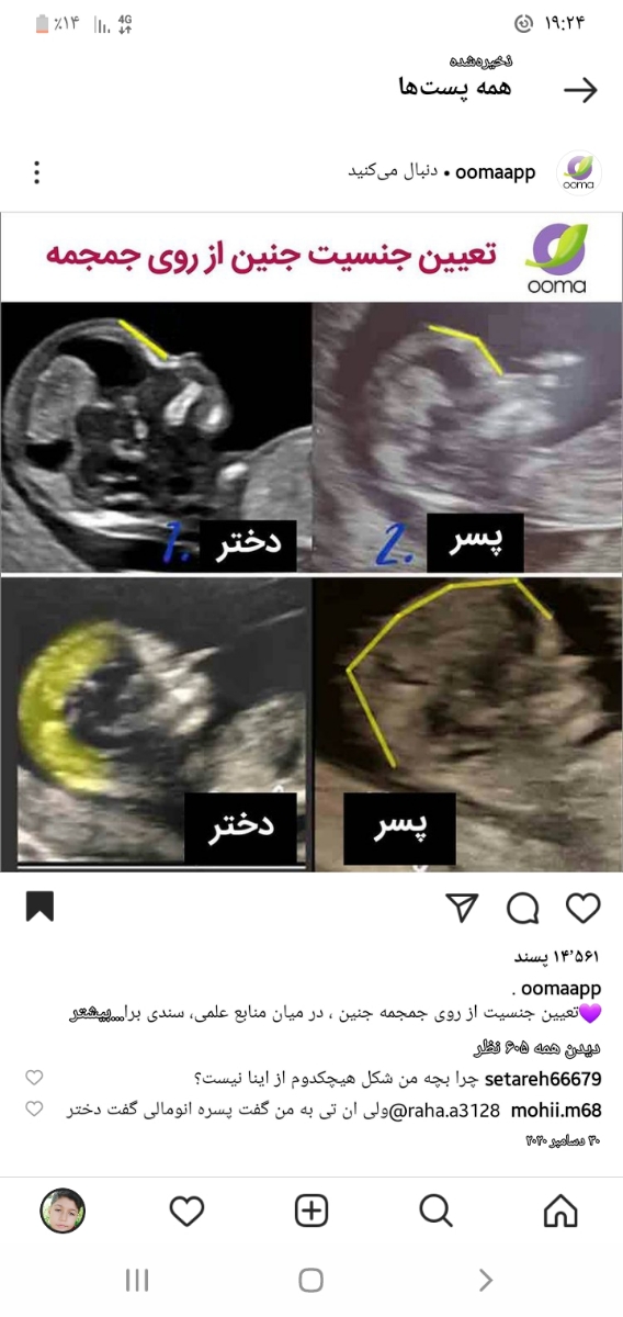 بچهها بیاید تعیین جنسیت کنید لطفا بچهها بیاید تعیین جنسیت کنید لطفا