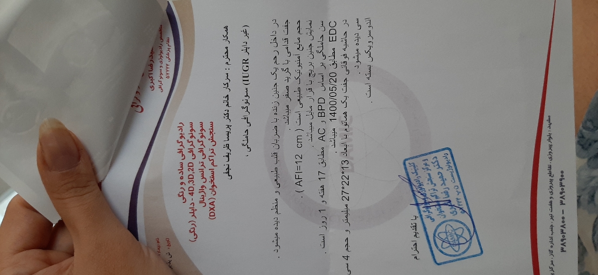 لکه بینی هفته ۱۷