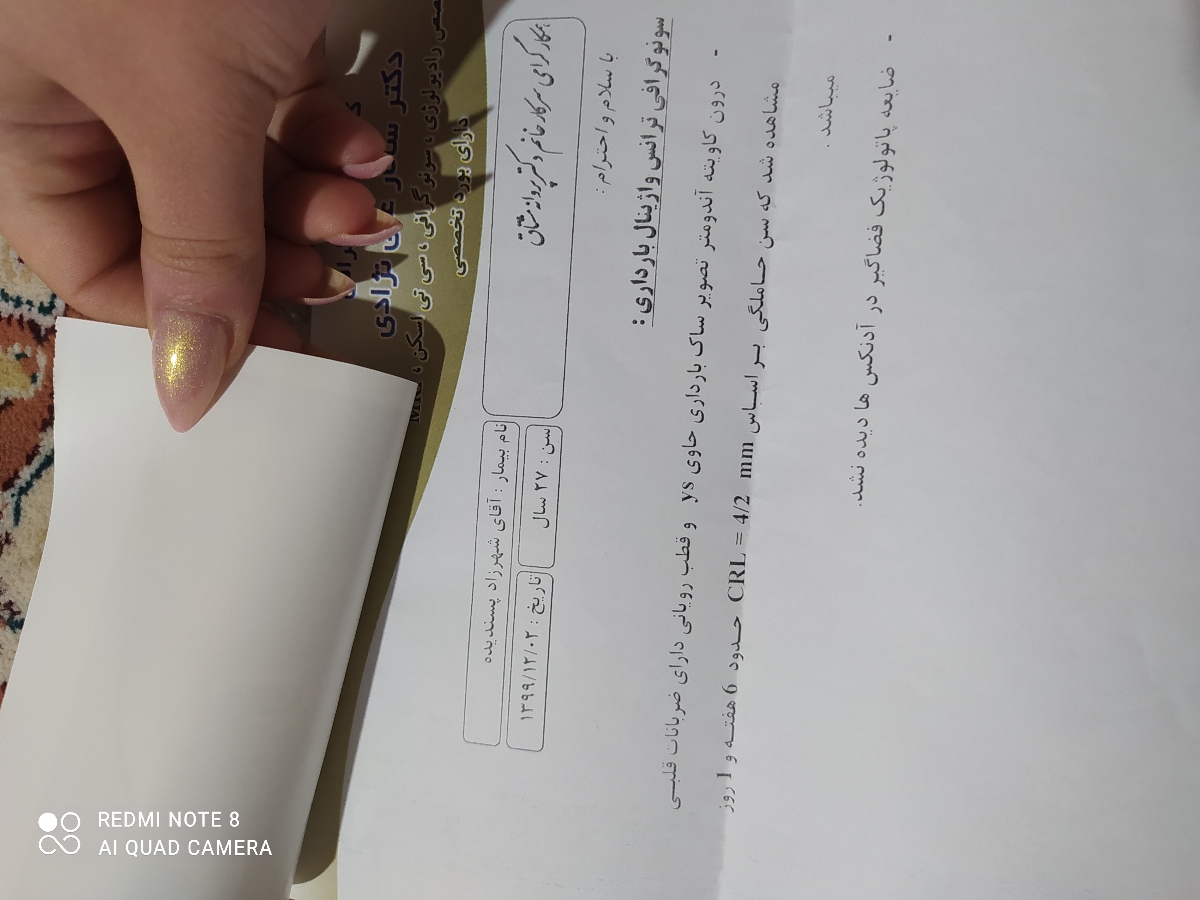 لکه بینی هفته ۱۷