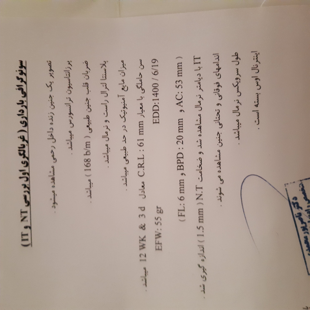 سونو گرافی ان تی