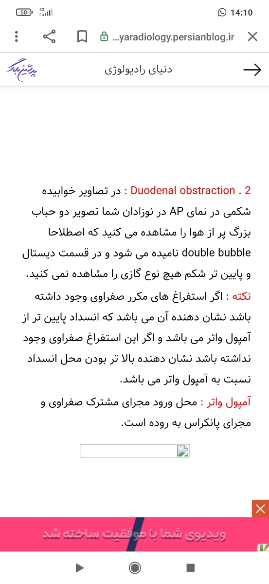 دوستان بیاین سونوگرافی منو ببینید خیلی میترسم
