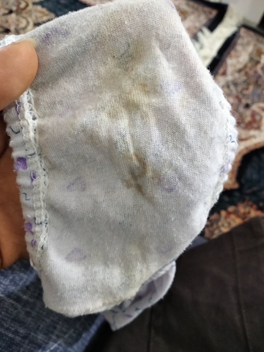 عکس ترشحات لطفا کسی بدش میاد نبینه عکس ترشحات لطفا کسی بدش میاد نبینه