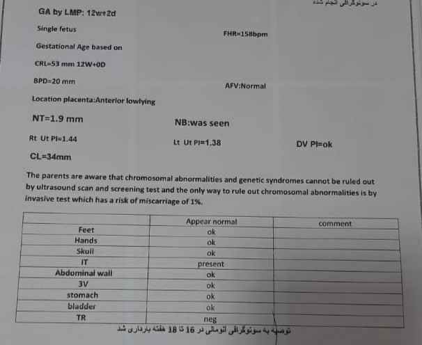 سونو ان تی 😍😍 متخصصا بیایین حدس بزنید💜😍