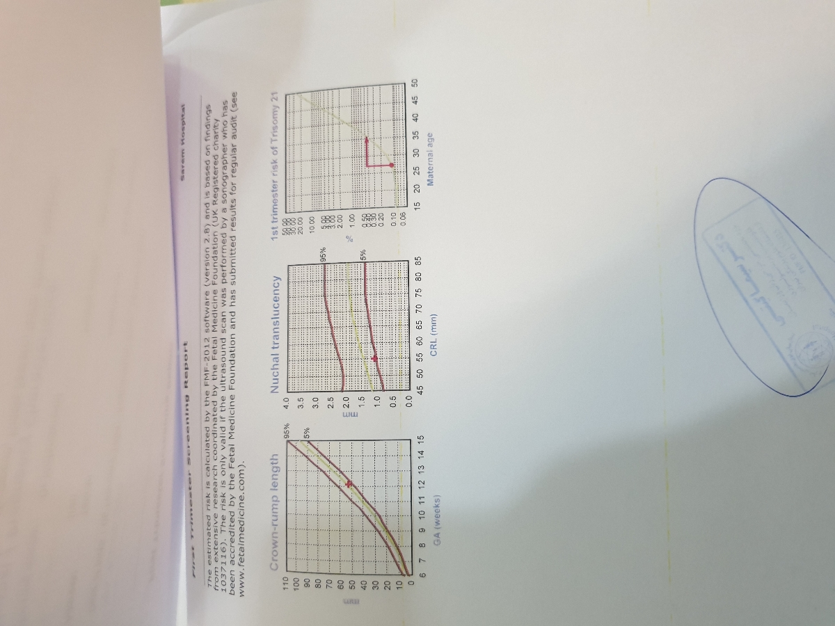 غربالگری NT ریسک سندرم داون رو زده بالا