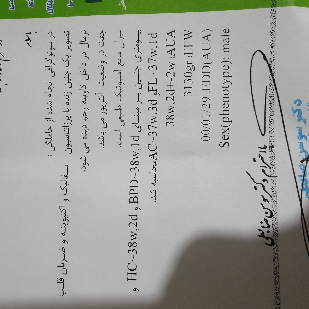 سونو ۳۸ هفته بارداری و چرخیدن جنین