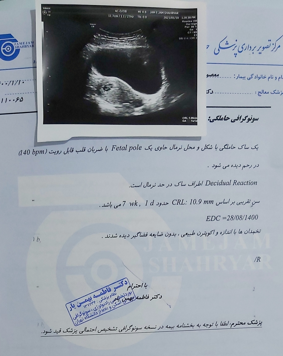 خون دیدم بیاید لطفا