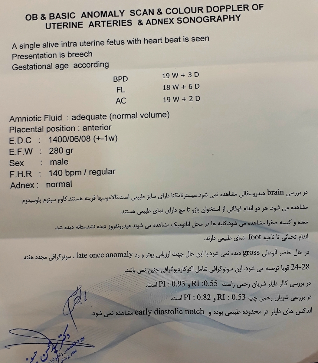 جواب سنو آنومالی 😊 جواب سنو آنومالی 😊