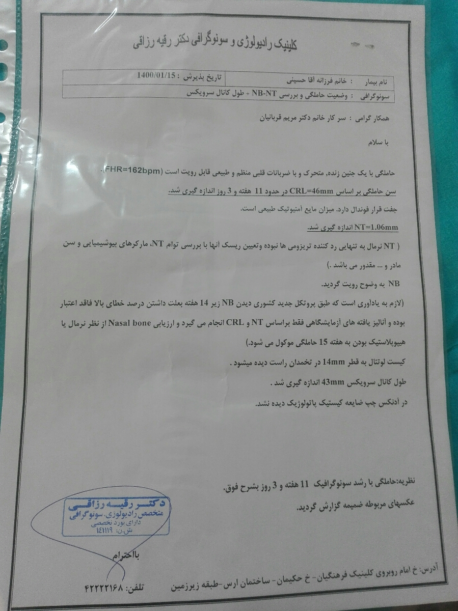 سونو ان تی منو ببینین سونو ان تی منو ببینین