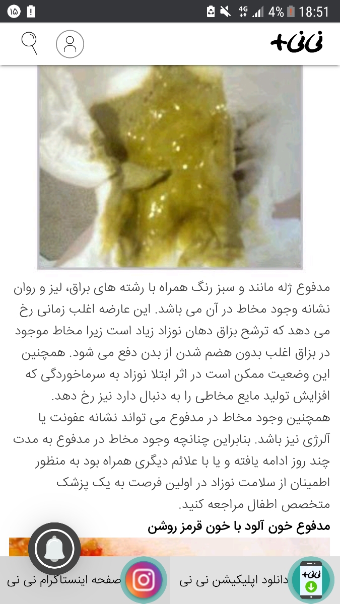دلیل اسهال کودک ۴ماهه دلیل اسهال کودک ۴ماهه