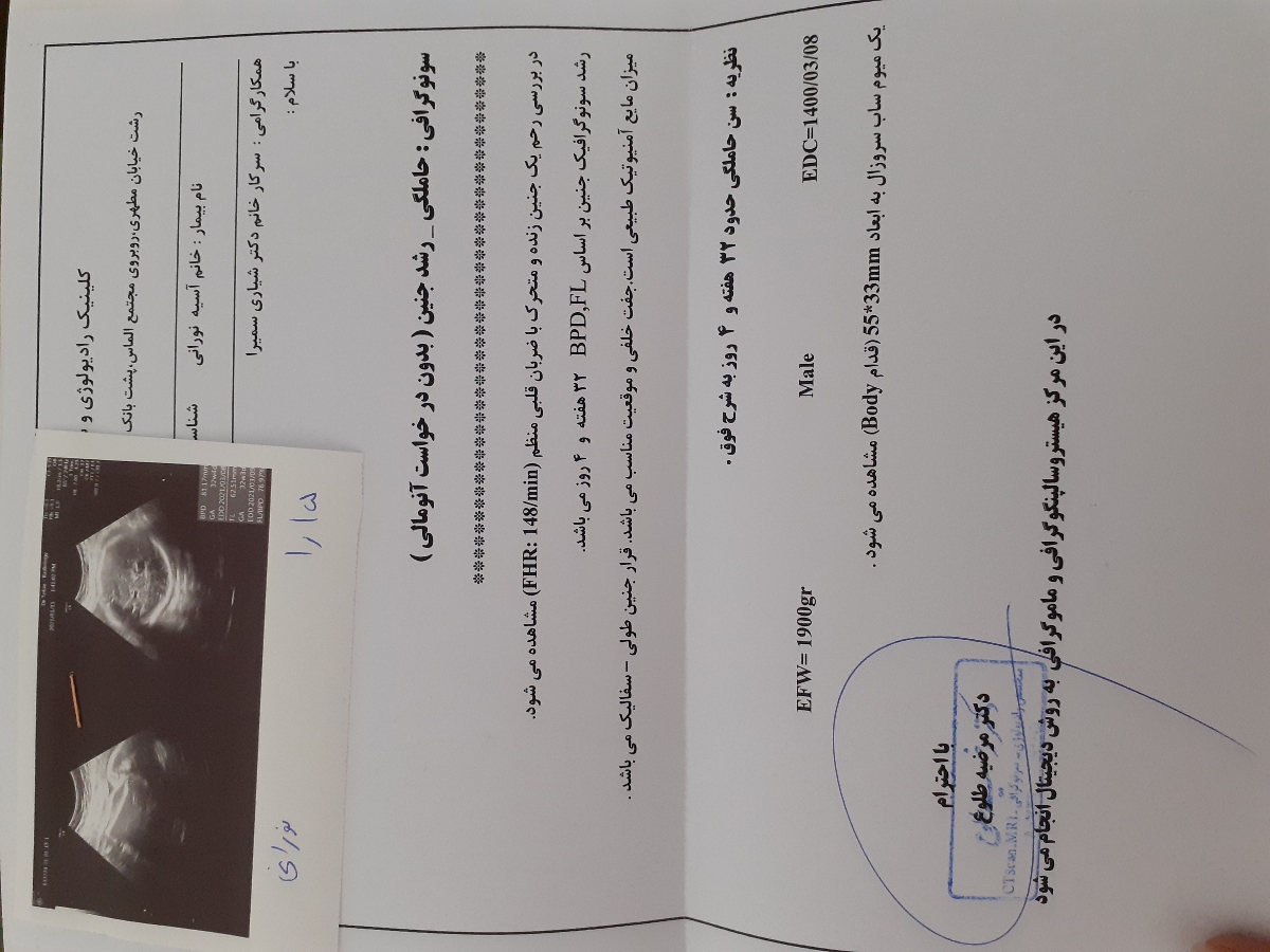 وزن جنین در ۳۲هفتگی