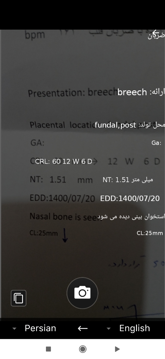 مامانا ک تعیین جنیست بلون بیایین و بگین ایا سنوم مشکلی نداره