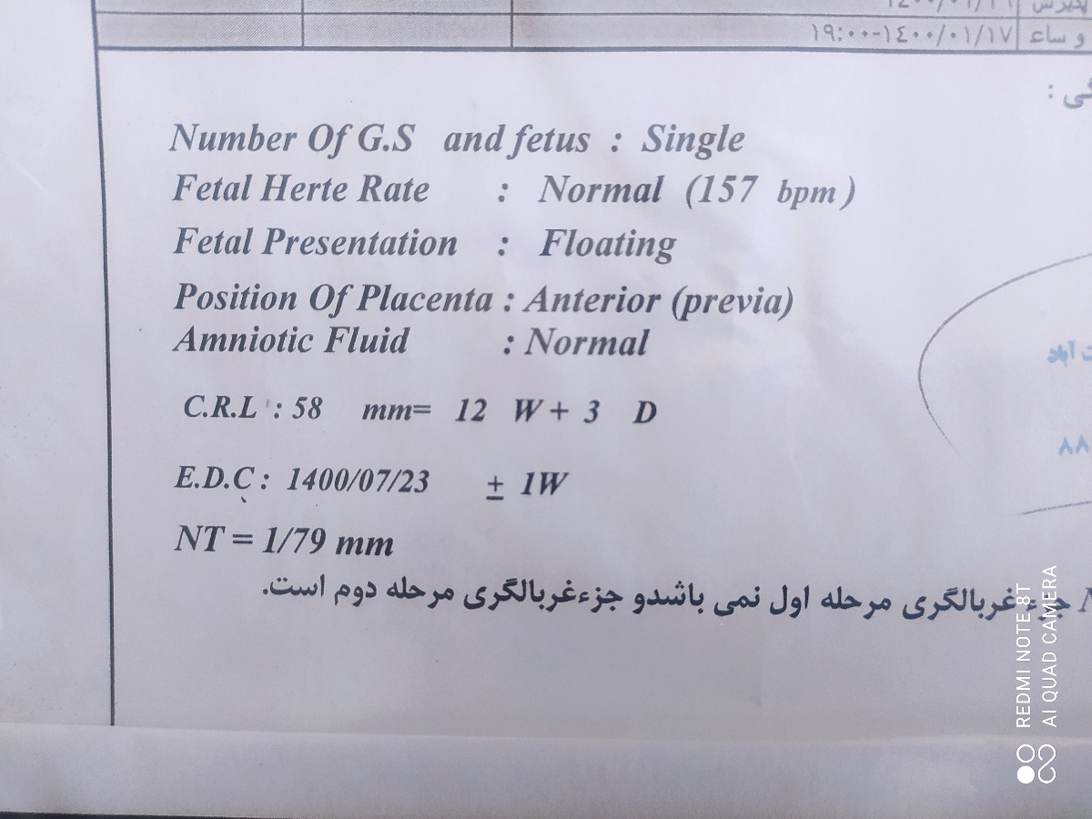 میشه جواب بدین ممنون