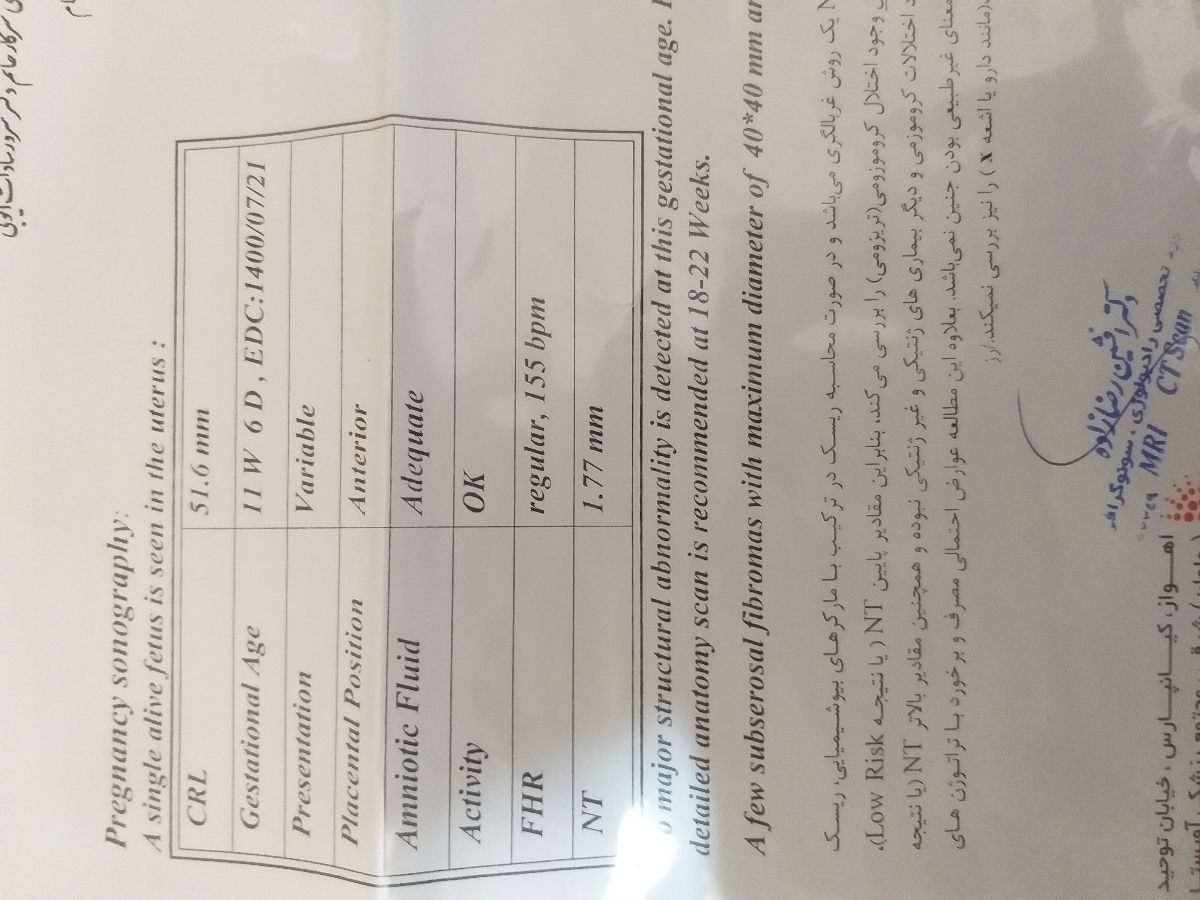 تفسیر جواب ان تی