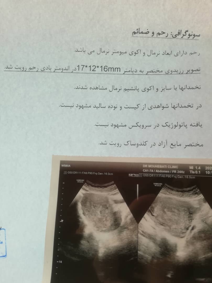 تفسیر سونو بعد زایما