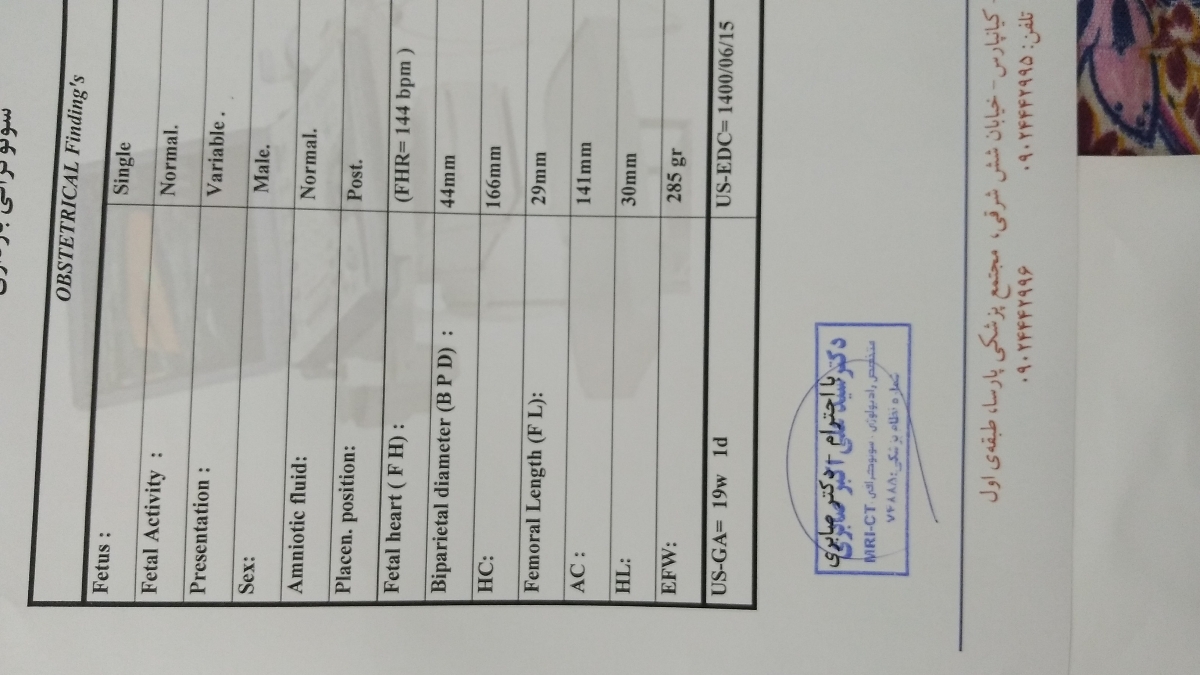 لطفا آنومالیم چک بشه