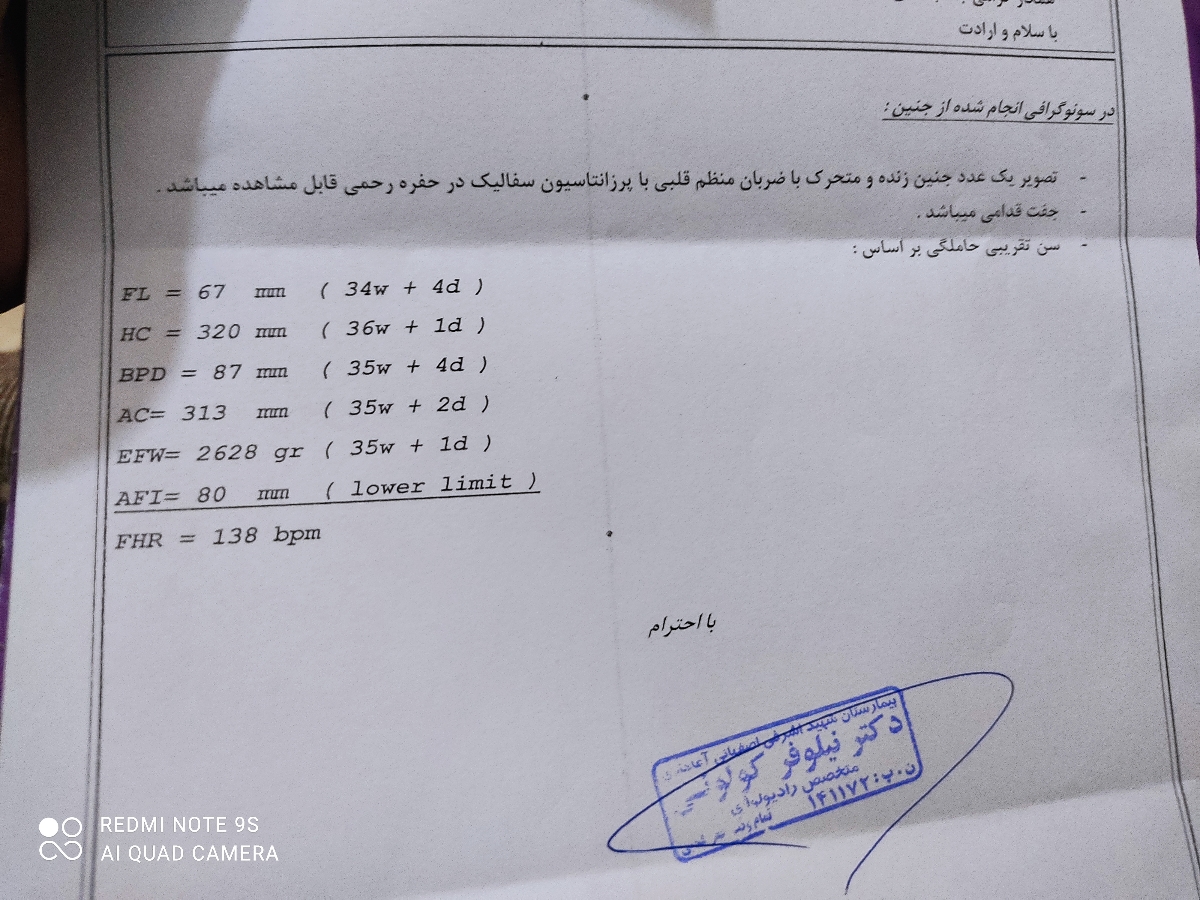 تفسیرسونوگرافی 35هفته و کم شدن اب دورجنین