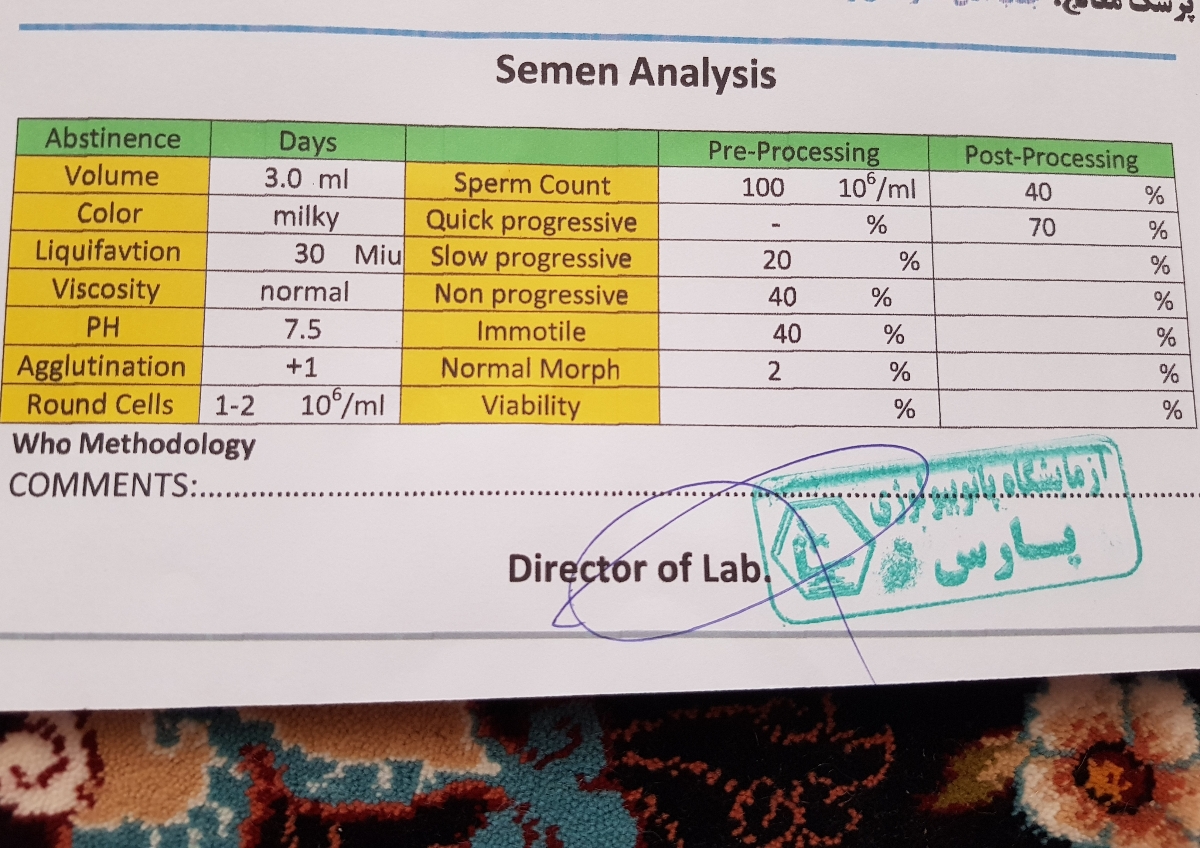 تفسیر ازمایش اسپرم همسرم