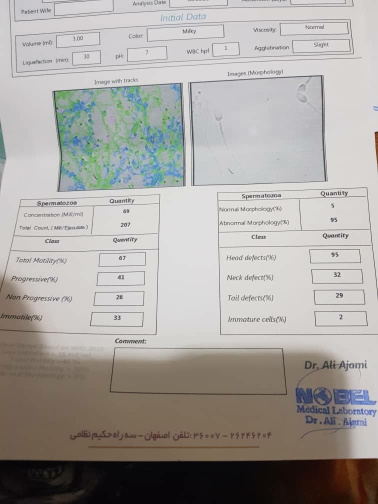 دوستانی ک بلدن جوتب ازمایش بخونن ازمایش اسپرم میشه بیان