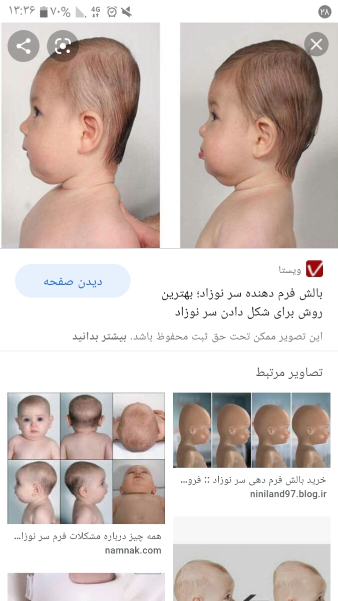 پشت کله دخترم صاف شده