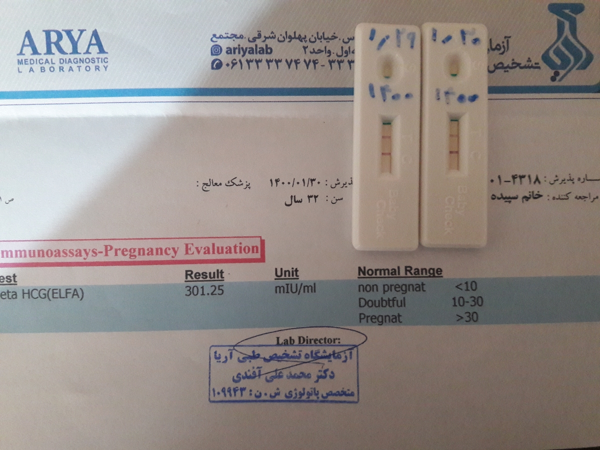 تست تشخیص بارداری بی بی چک