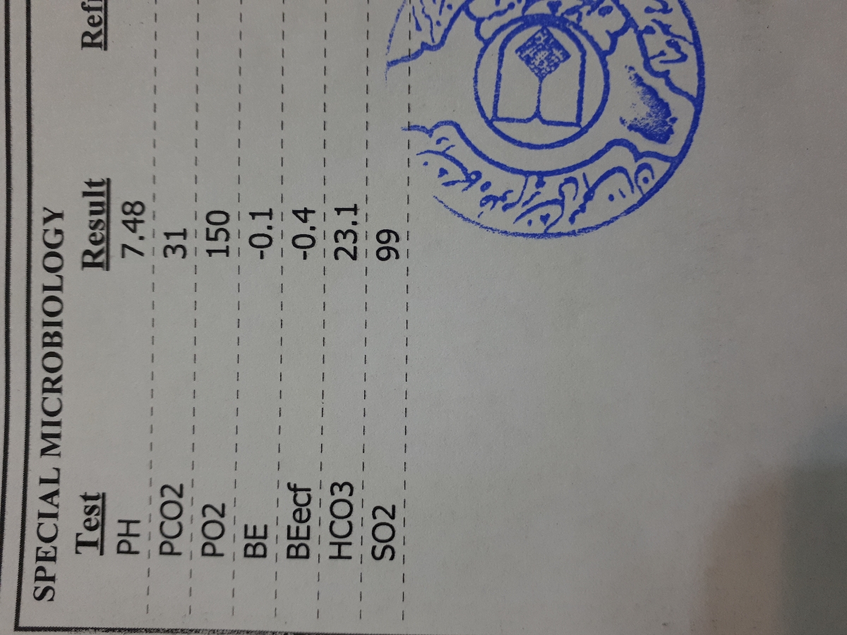 تفسیر ازمایش خون پسر۴۳ روزه ام