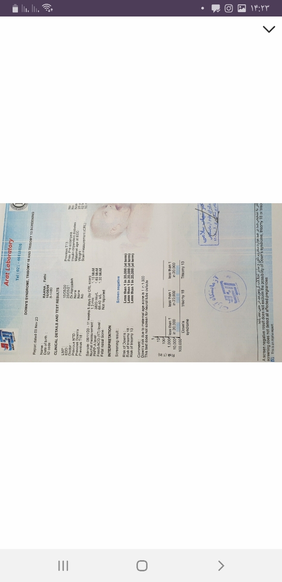 دخترا هیچ جوره به غیر از سونو نمیشه فهمید جنسیت بچه چیه؟