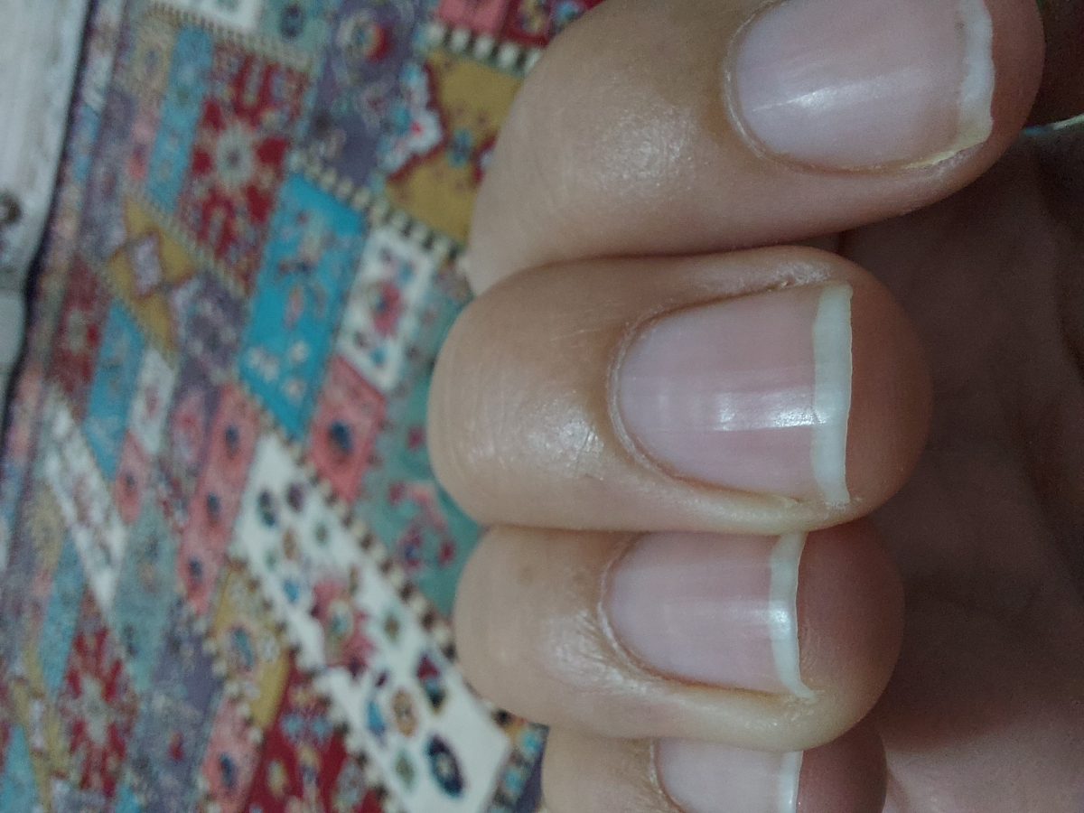 ناخنام چرا موج دارن عزیزا