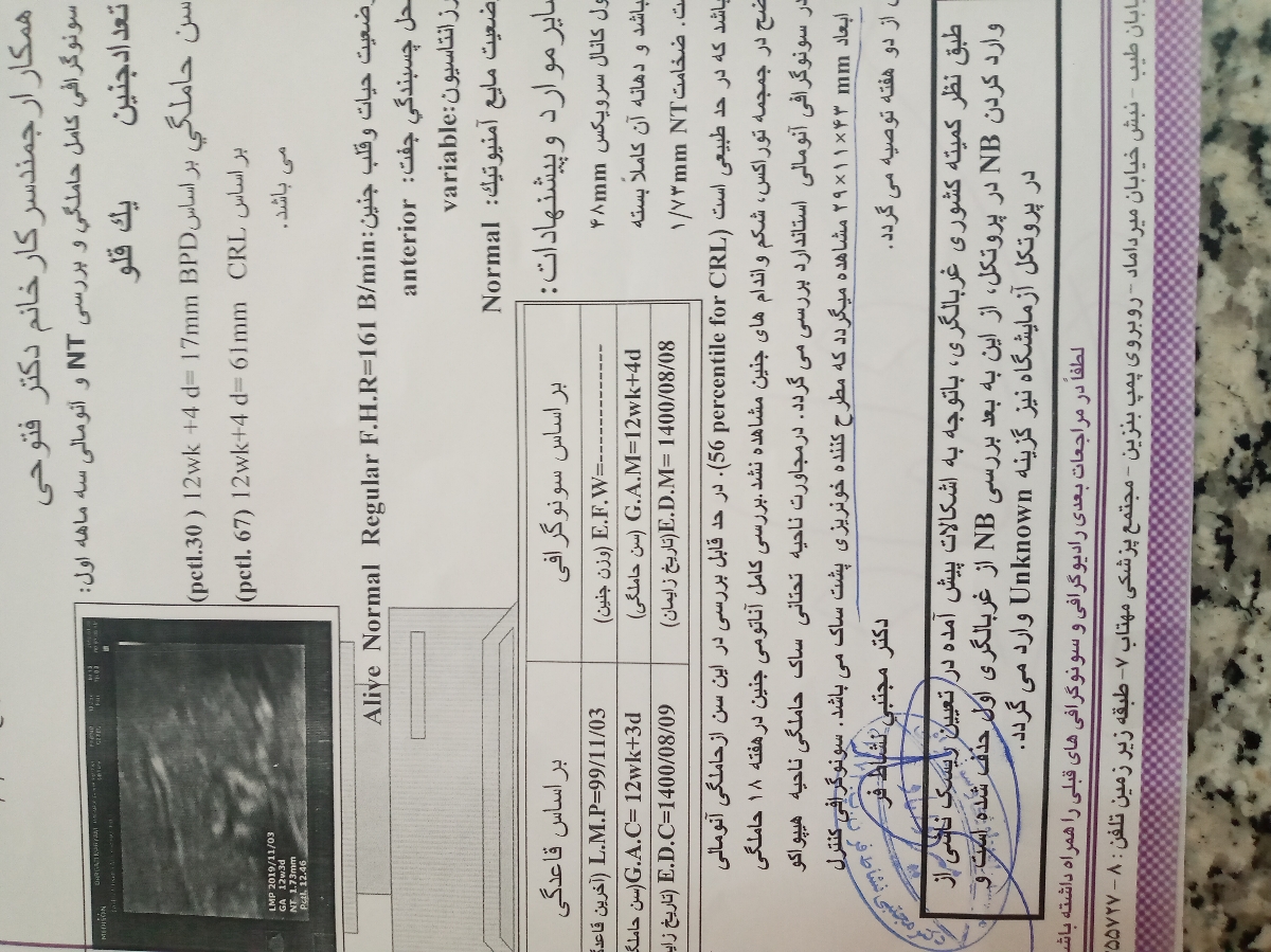 سونوگرافی هفته چهاردهم