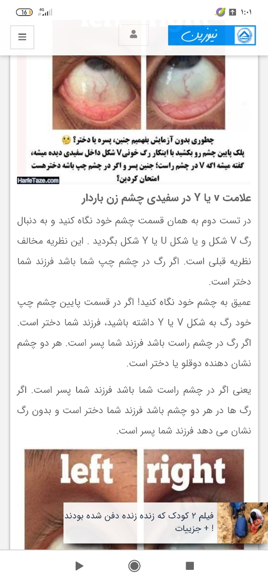 جنسیت جنین از روی چشم جنسیت جنین از روی چشم