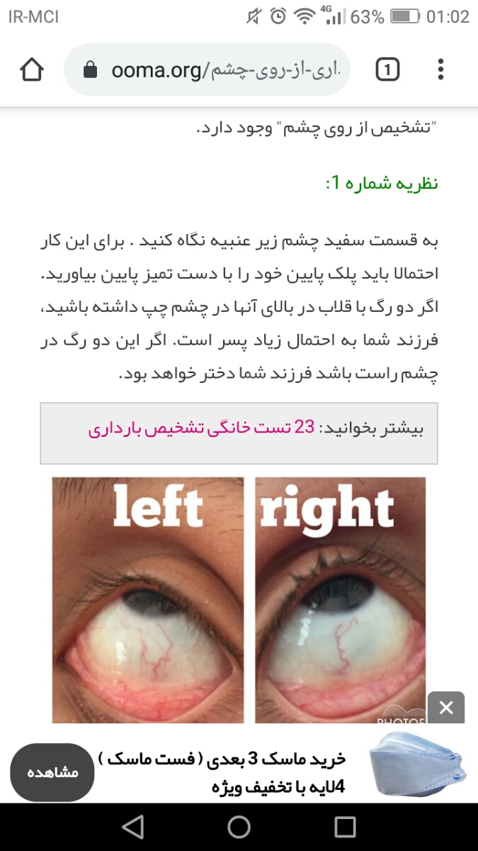 جنسیت جنین از روی چشم جنسیت جنین از روی چشم