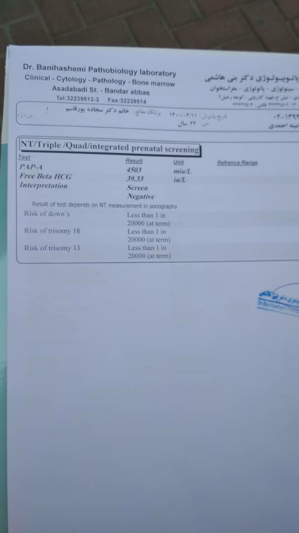 تفسیر کامل سونو ان تی؟