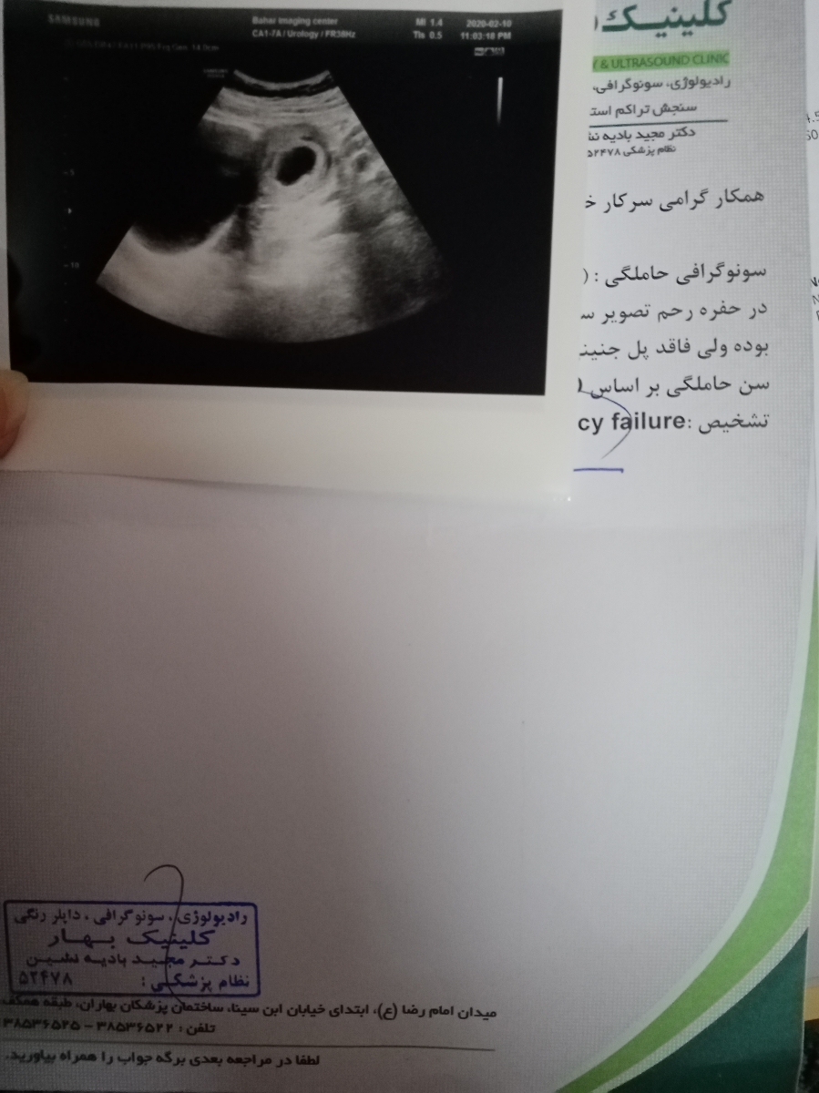 دکتر اوما میشه سونو منو ببینید