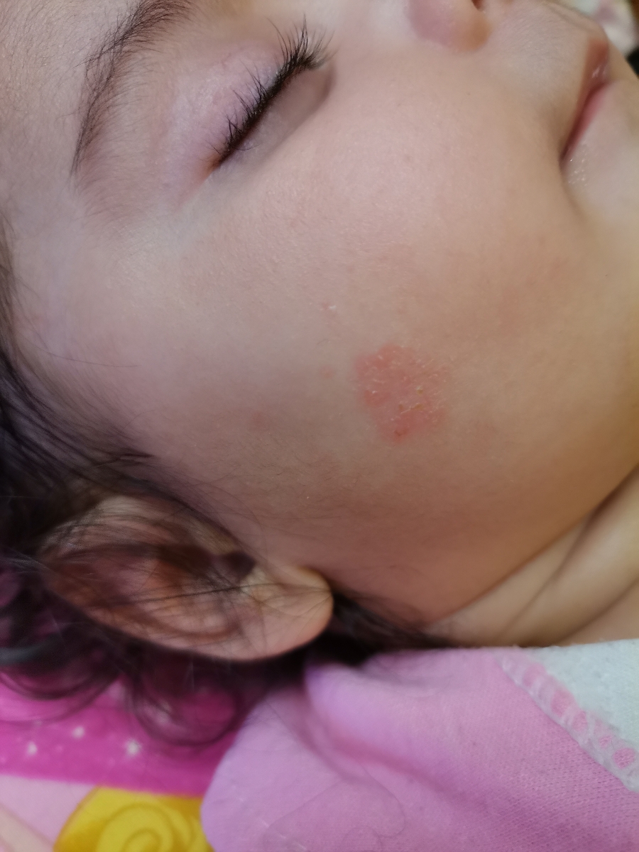 لک روی صورت دخترم لک روی صورت دخترم