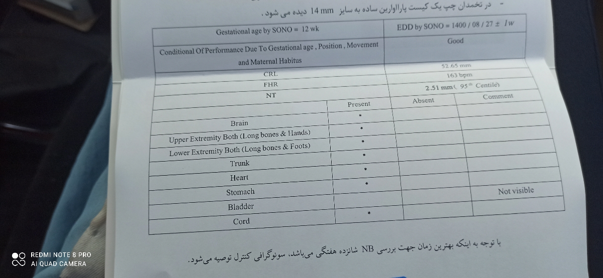 غربالگری مرحله اول و سونو NT انجام دادم