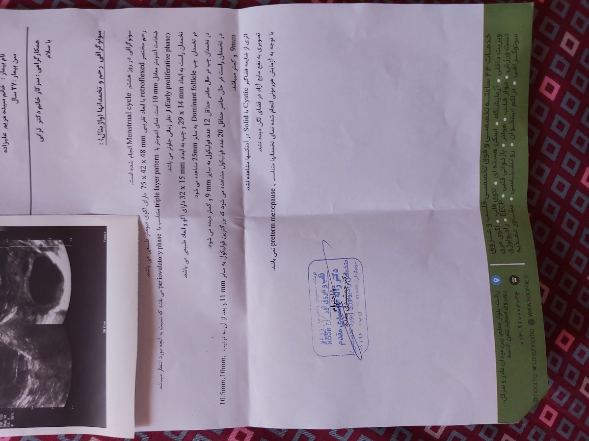 تفسیر سونو روز ٨ قاعدگی تفسیر سونو روز ٨ قاعدگی