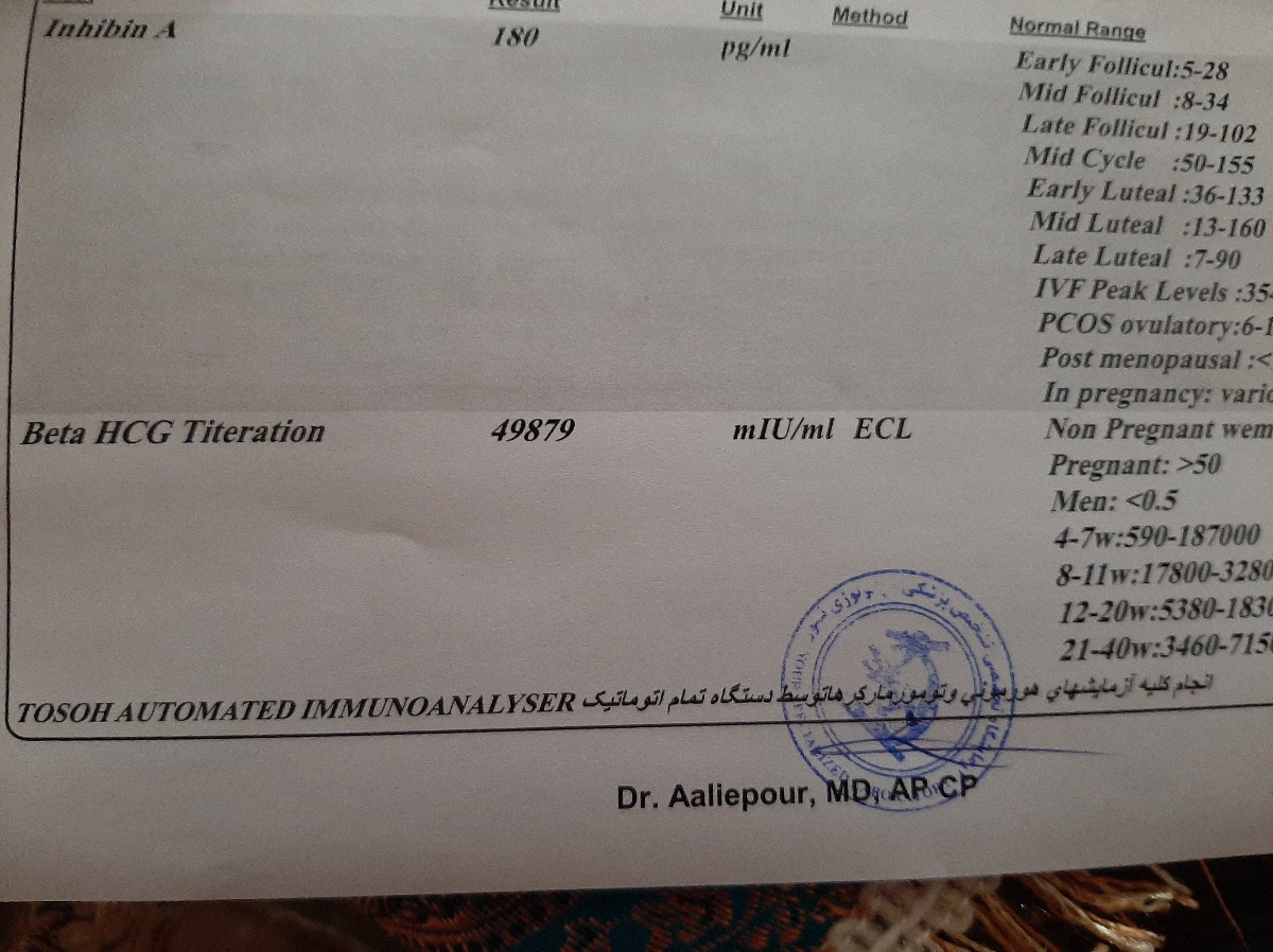 تفسیر ازمایش غربالگری دوم