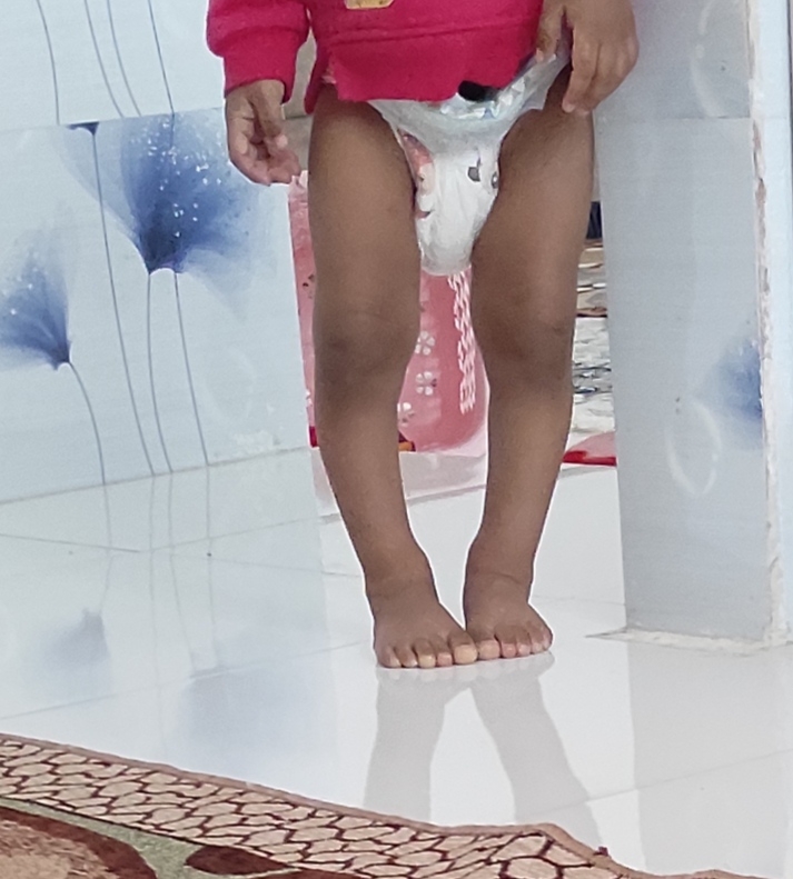 ایا پاهای بچم پرانتزیه؟؟؟😔