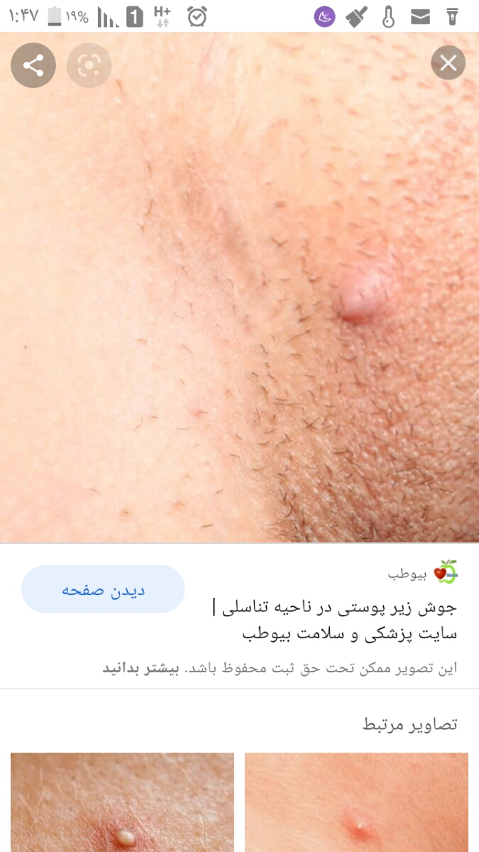 خانمها تایپیک عکس داره بدتون میاد باز نکنید