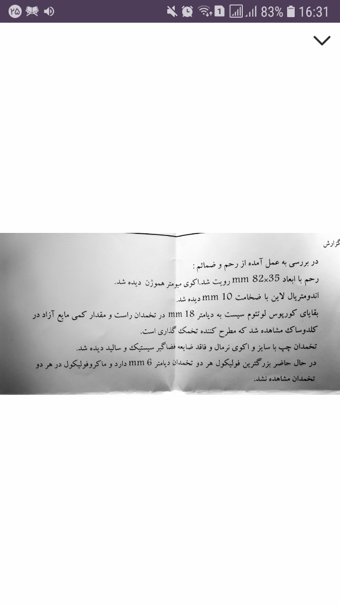 ترشحات کش دار و زمان تخمک گزاری