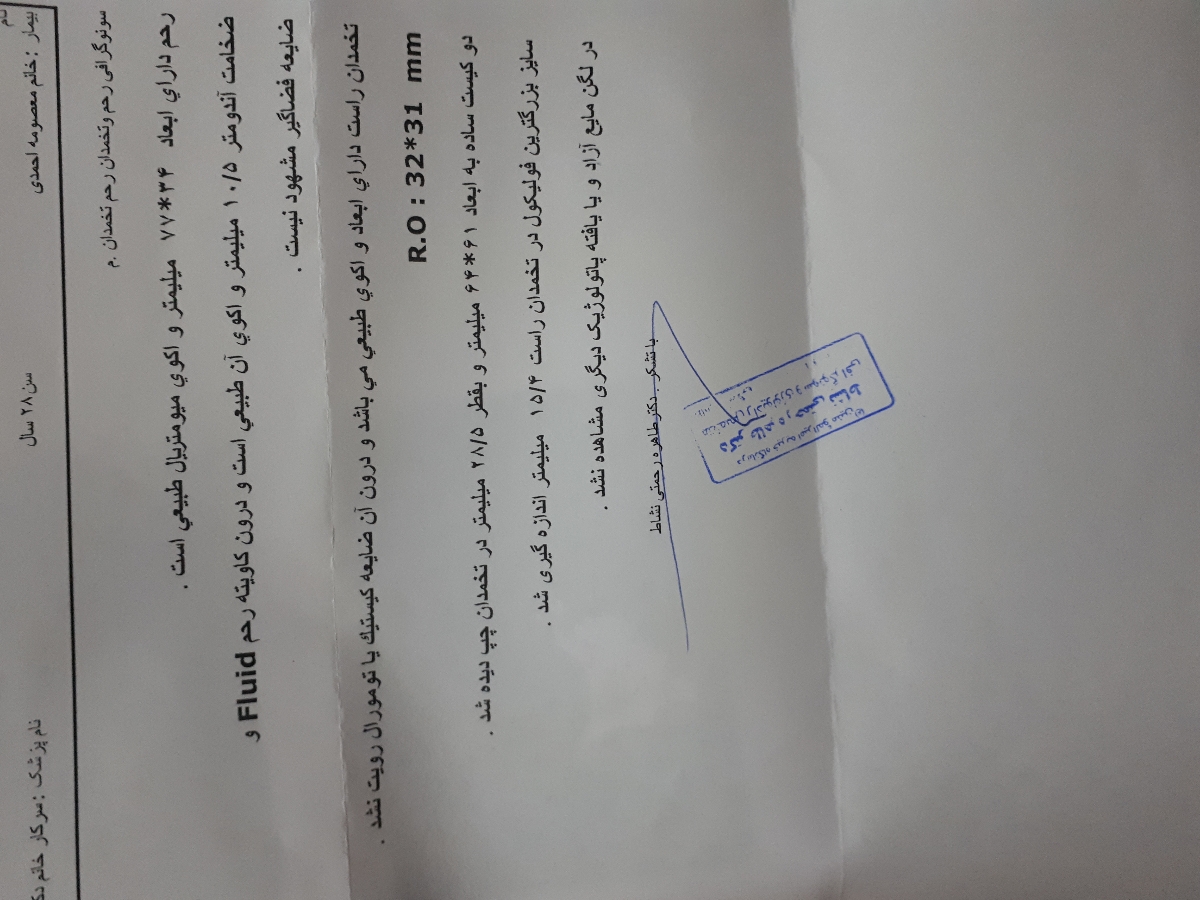 درد تخمدان سمت چپ به علت کیست فولیکولی