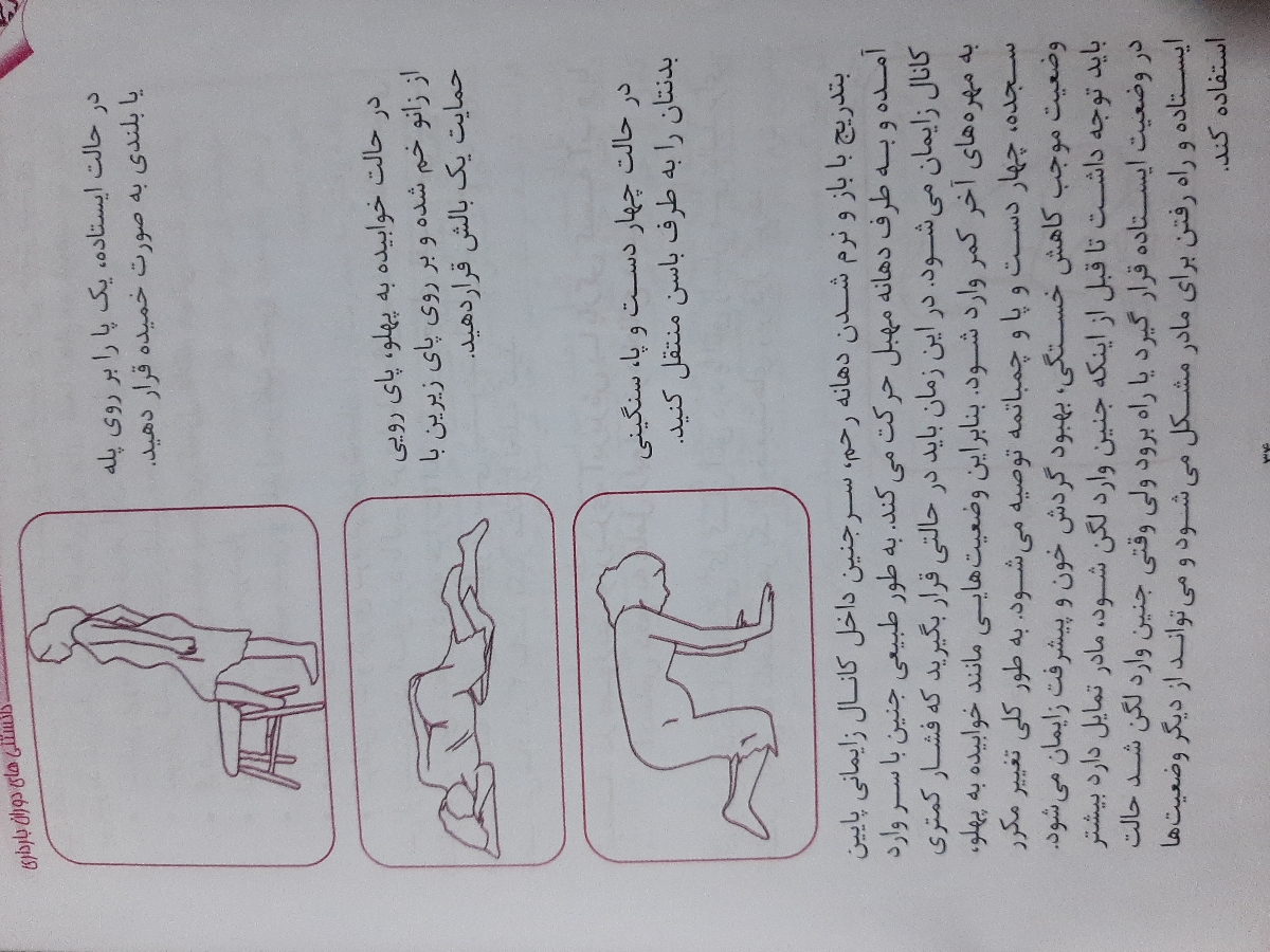 باز شدن دهانه رحم در ۴۰ هفته