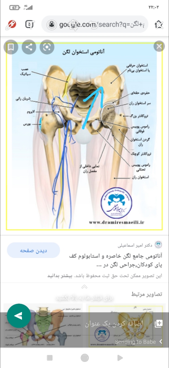 علت دردناگهانی استخوان لگن