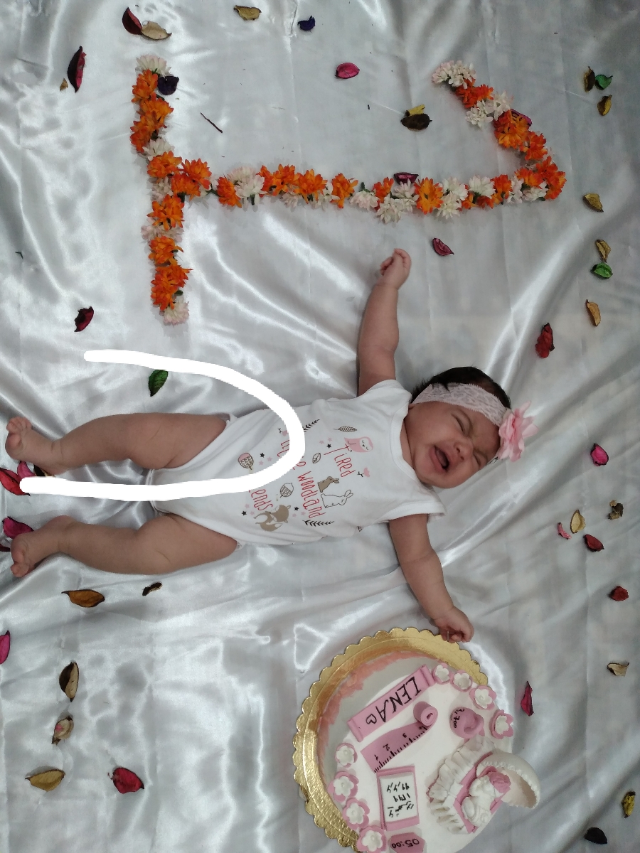 سلام خانما یه نگاهی به پای بچم میکنین