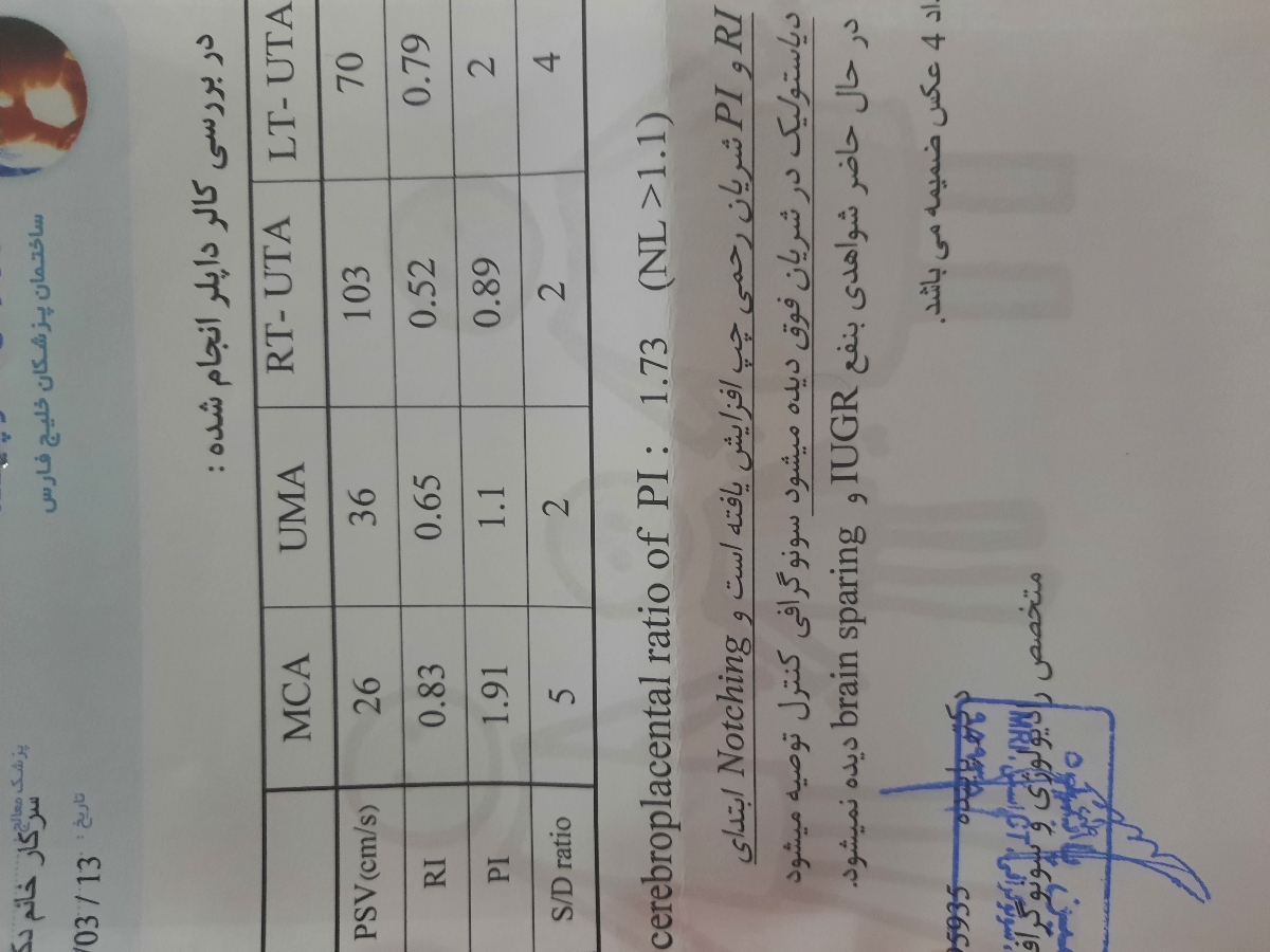 دکتر اوما لطفا سونو داپلر منو تفسیر کنید