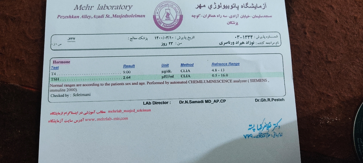 تفسیرجواب ازمایش تیروییدنوزاد۳۰روزه ببینیدخوبه یانه