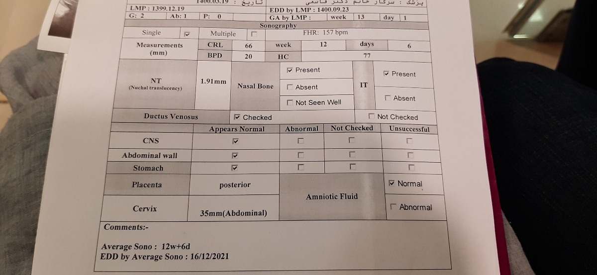 تفسیر سونوntو تعیین جنسیت