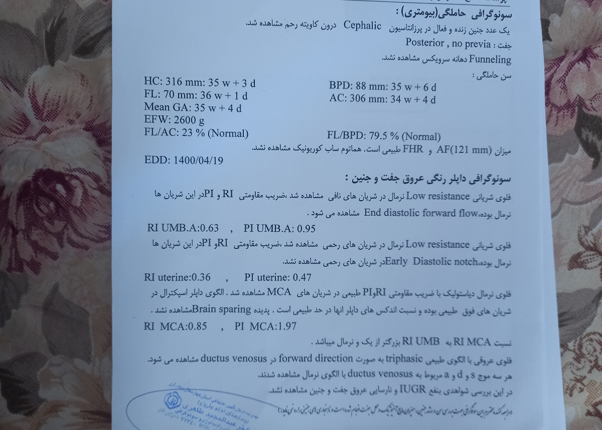 سونو داپلر و وزن جنین سونو داپلر و وزن جنین