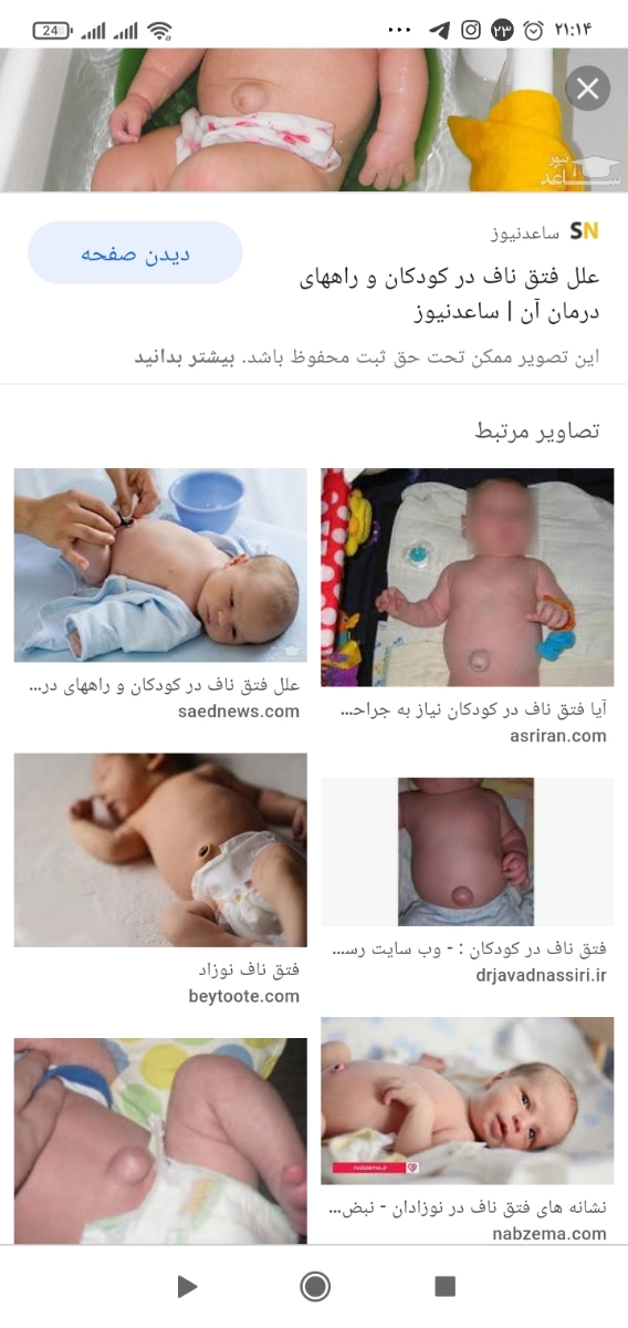سوال درمورد ناف نوزاد